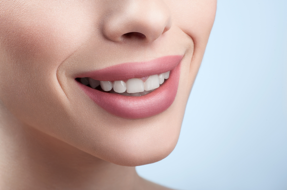 Teeth Whitening in Cordova